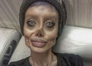 Teen dubbed 'Corpse Bride