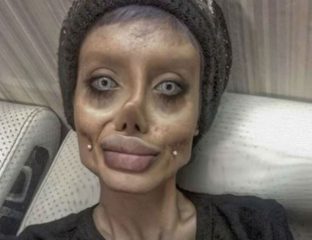 Teen dubbed 'Corpse Bride