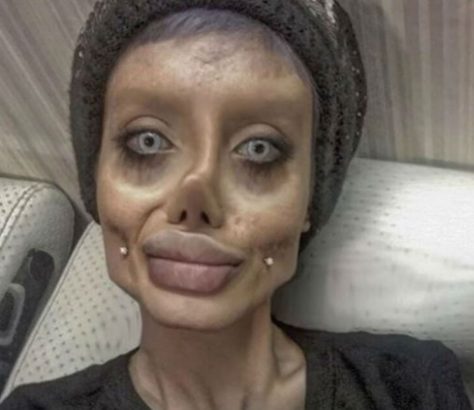 Teen dubbed 'Corpse Bride